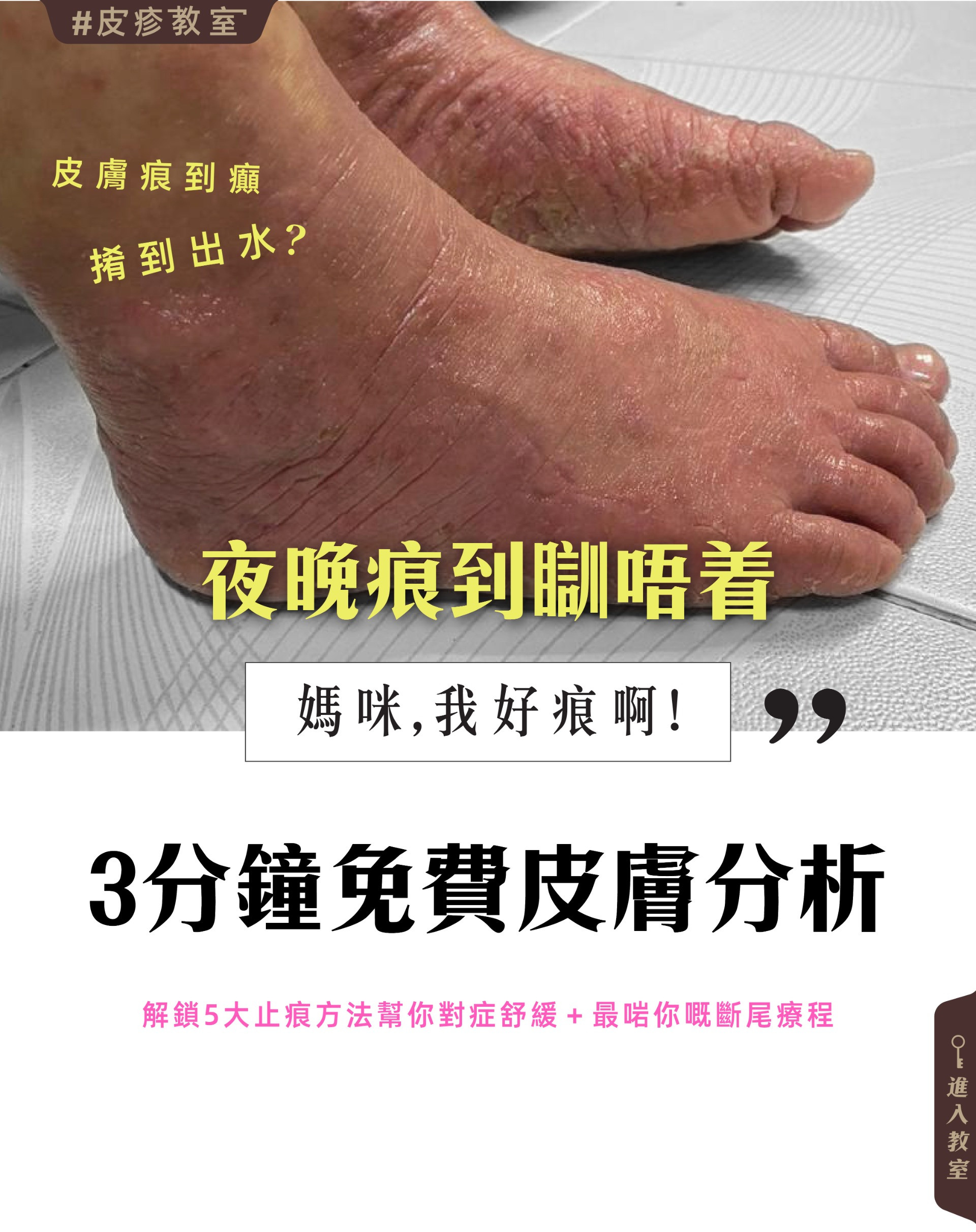 更新封面圖